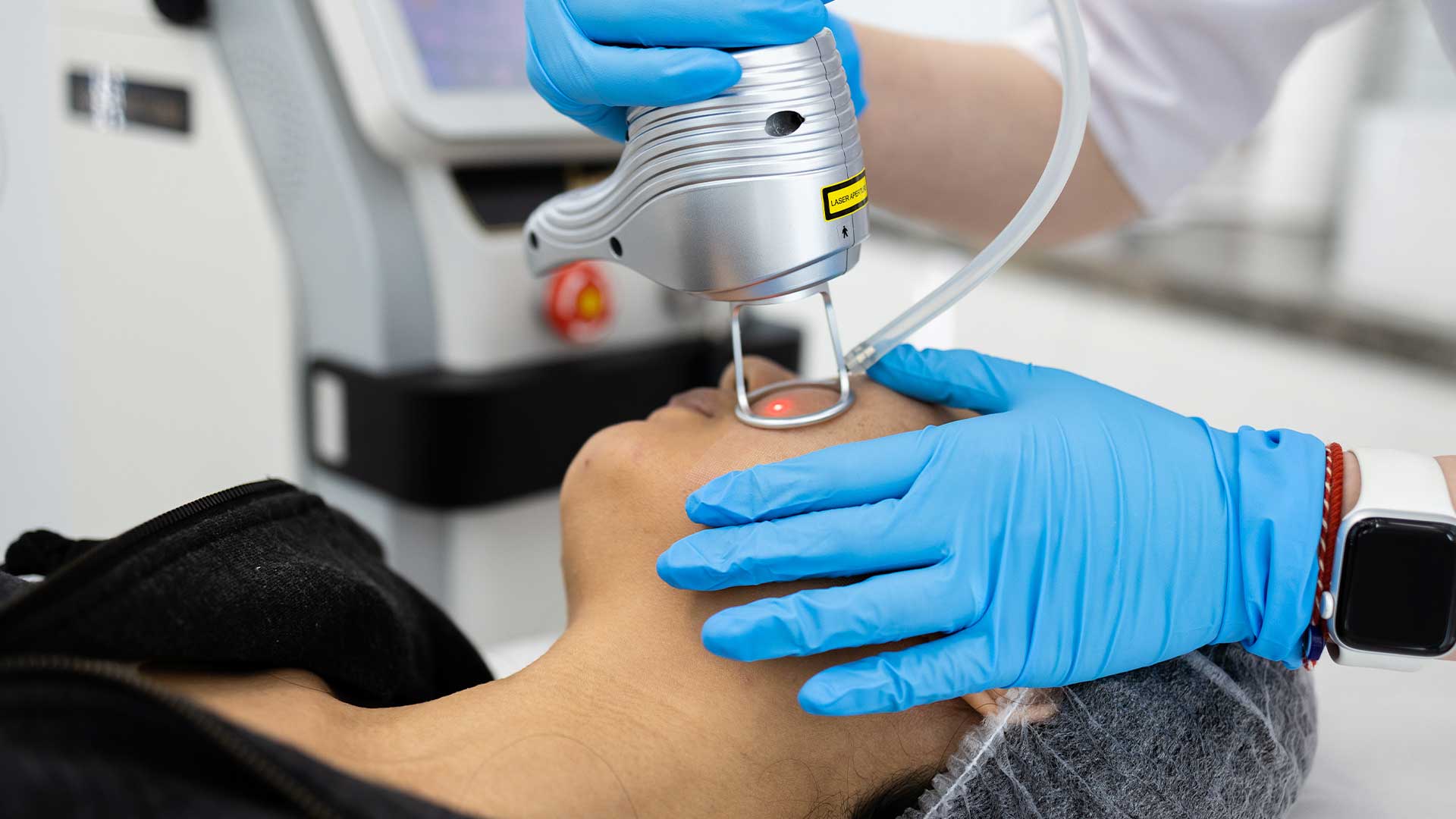 Laser Treatment in Red Deer