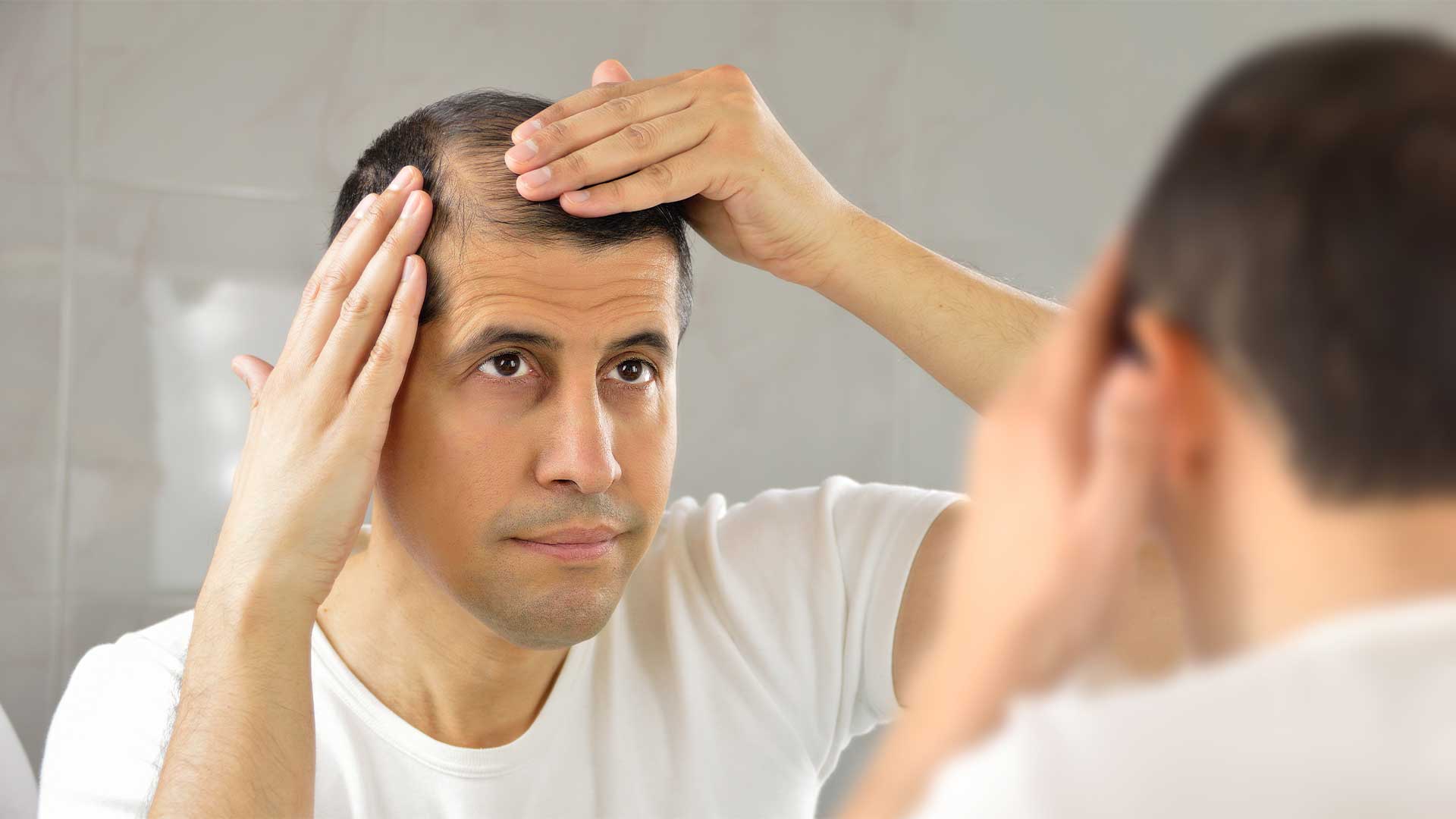 Man With Receding Hairline