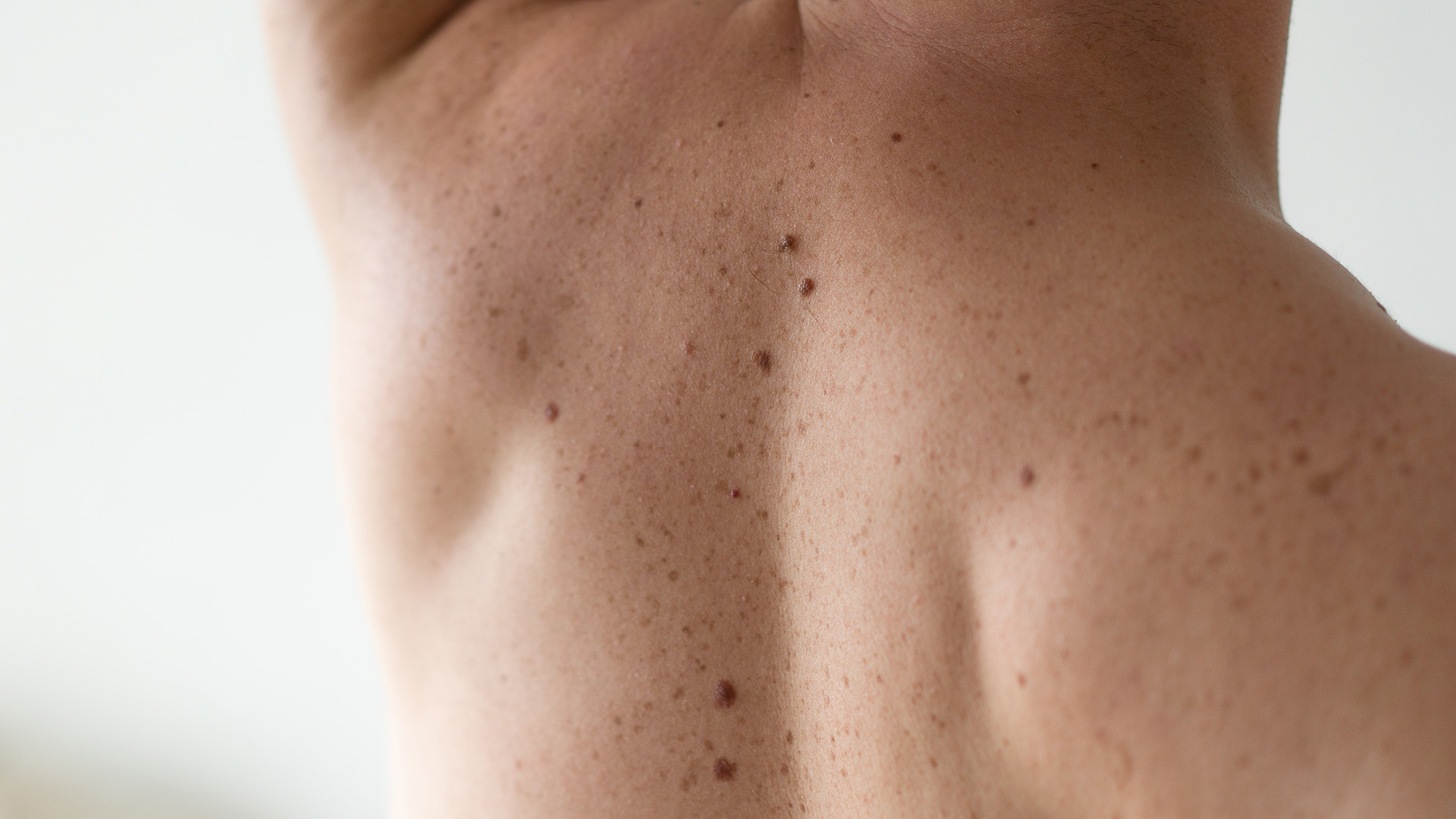 Mole Mapping
