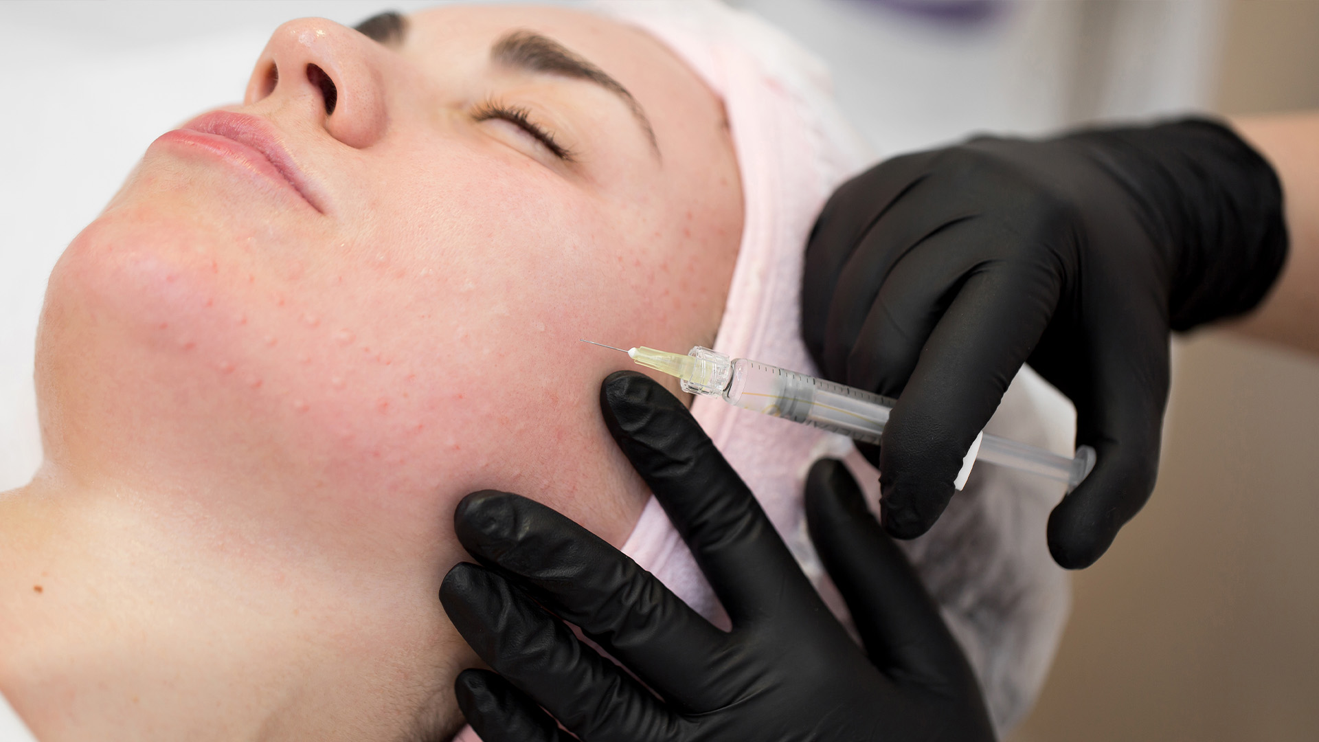 Skin Boosters