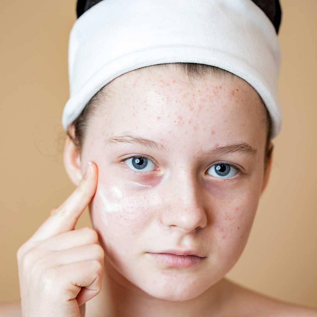 Teenager Applying Skincare