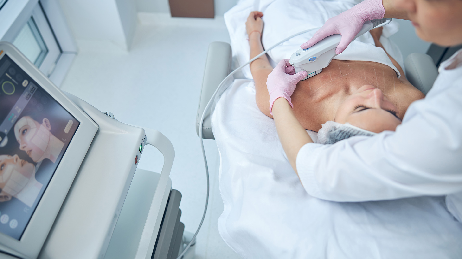 Ultherapy